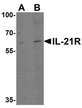 IL-21 Receptor Antibody