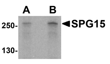 ZFYVE26 Antibody