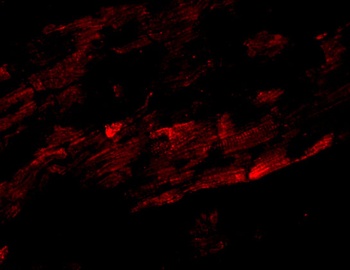 ZFYVE26 Antibody
