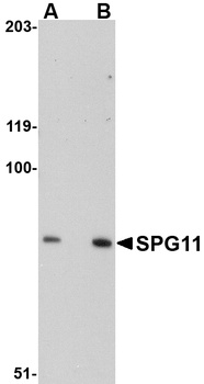 SPG11 Antibody