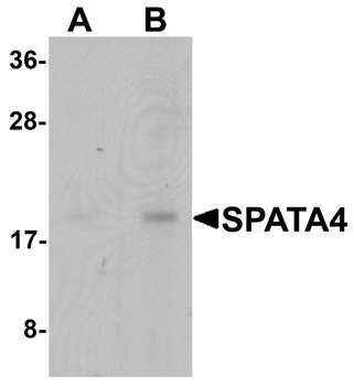 SPATA4 Antibody