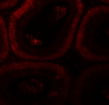 SPATA3 Antibody