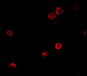 SOGA1 Antibody