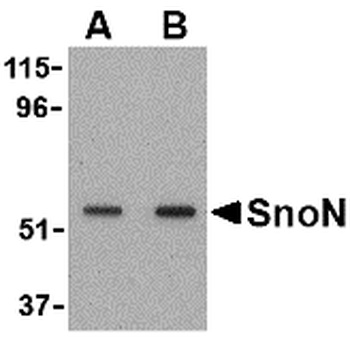 SKIL Antibody