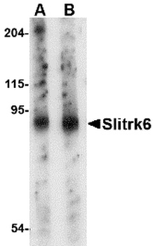 SLITRK6 Antibody