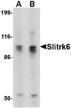 SLITRK6 Antibody