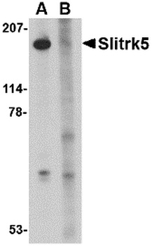 SLITRK5 Antibody