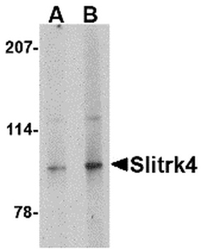 SLITRK4 Antibody