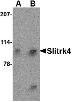 SLITRK4 Antibody