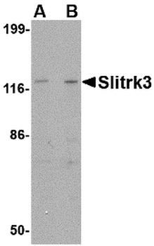 SLITRK3 Antibody