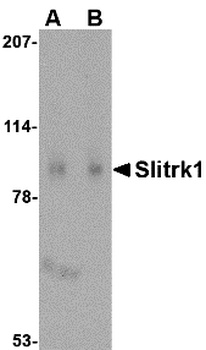 SLITRK1 Antibody