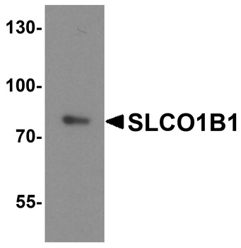 SLCO1B1 Antibody