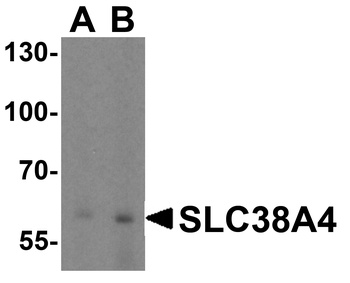 SLC38A4 Antibody