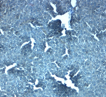 SLC38A4 Antibody