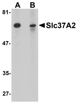 SLC37A2 Antibody