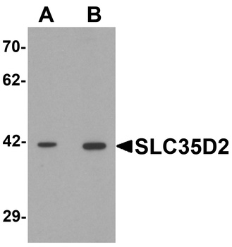 SLC35D2 Antibody