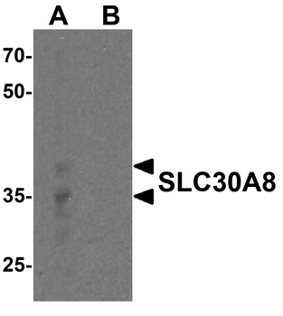 SLC30A8 Antibody