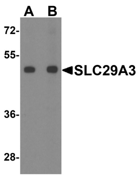 SLC29A3 Antibody