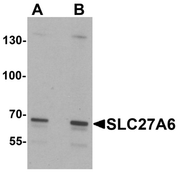 SLC27A6 Antibody