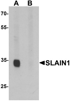 SLAIN1 Antibody