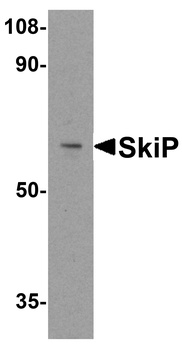 SNW1 Antibody