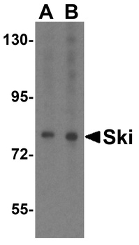 Ski Antibody