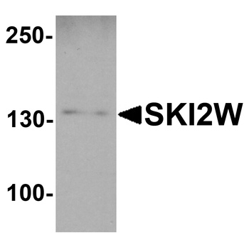 SKIV2L Antibody