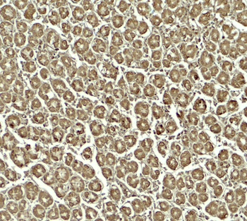 SKIV2L Antibody