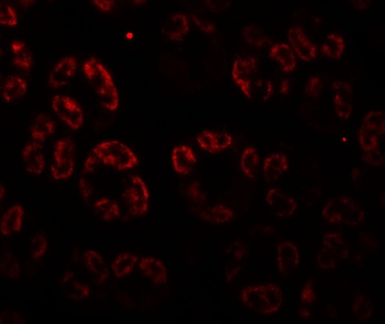SKIV2L Antibody