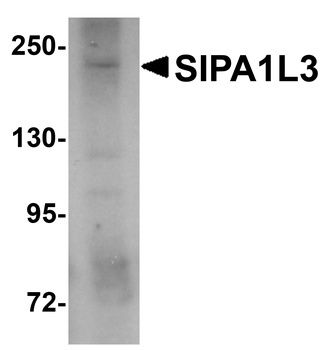 SIPA1L3 Antibody