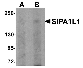 SIPA1L1 Antibody