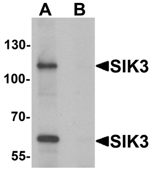 SIK3 Antibody