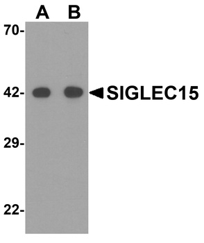 SIGLEC15 Antibody