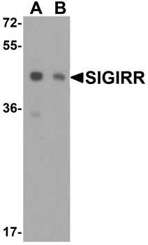 SIGIRR Antibody