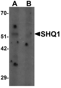 SHQ1 Antibody