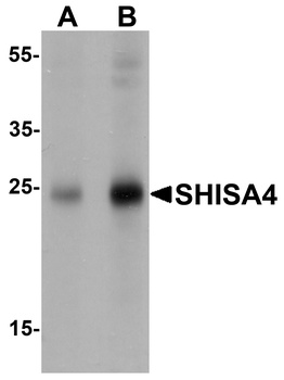 SHISA4 Antibody