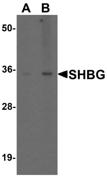 SHBG Antibody