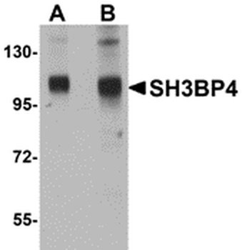 SH3BP4 Antibody