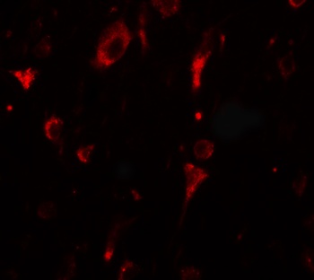 SGSM2 Antibody