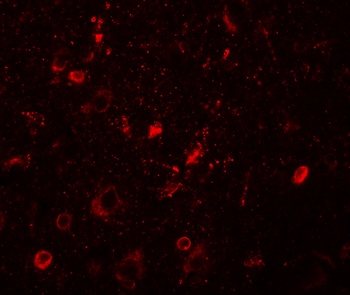 SGSM1 Antibody