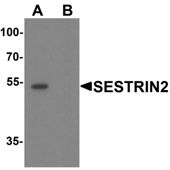 SESN2 Antibody