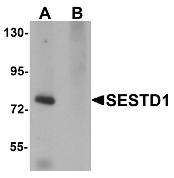 SESTD1 Antibody