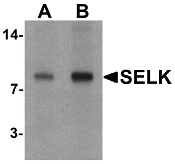 SELK Antibody