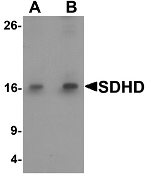 SDHD Antibody
