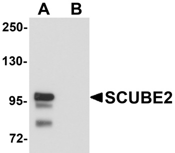SCUBE2 Antibody