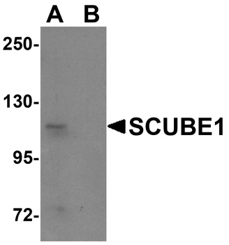 SCUBE1 Antibody