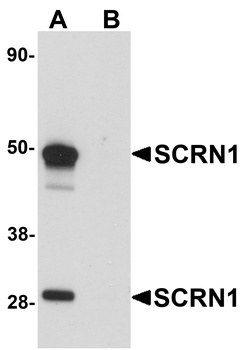SCRN1 Antibody