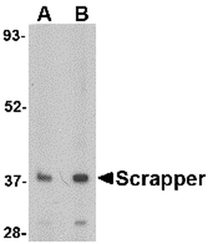 FBXL20 Antibody