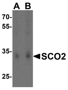 SCO2 Antibody