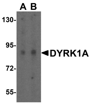 DYRK1A Antibody